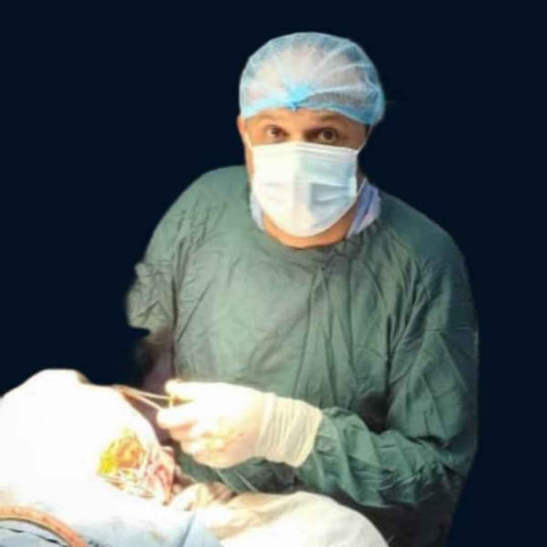 أضراس العقل المنطمرة تشريحياً