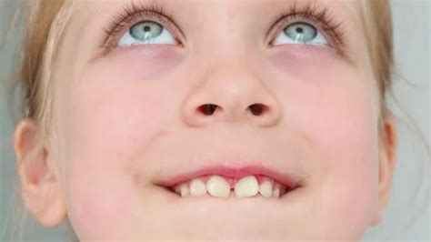 طب أسنان الأطفال